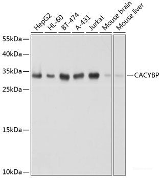 Immunohistochemistry of paraffin-embedded Rat kidney using RNASEL Polyclonal Antibody at dilution of 1:100 (40x lens).