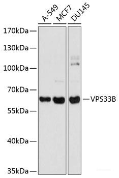 Immunohistochemistry of paraffin-embedded Human prostate using ABCC3 Polyclonal Antibody at dilution of 1:100 (40x lens).
