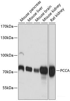 Immunohistochemistry of paraffin-embedded Rat kidney using Phospho-ABL1(Y245) Polyclonal Antibody at dilution of 1:100 (40x lens).