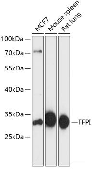 Immunohistochemistry of paraffin-embedded Rat brain using SEPT5 Polyclonal Antibody at dilution of 1:100 (40x lens).