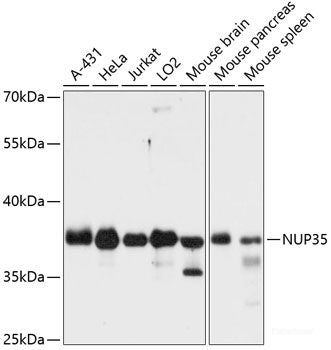Immunohistochemistry of paraffin-embedded Human placenta using IGF2R Polyclonal Antibody at dilution of 1:100 (40x lens).