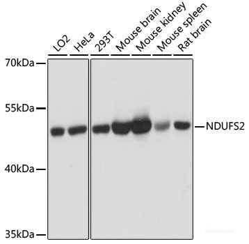 Western blot analysis of extracts of various cell lines using SF3B6 Polyclonal Antibody at dilution of 1:3000.