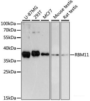Immunofluorescence analysis of A549 cells using TESK2 Polyclonal Antibody