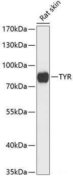 Western blot analysis of extracts of Human serum using PLA2G7 Polyclonal Antibody at dilution of 1:1000.
