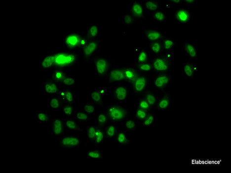 Immunohistochemistry of paraffin-embedded Rat liver using HUS1 Polyclonal Antibody at dilution of 1:100 (40x lens).