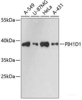 Immunohistochemistry of paraffin-embedded Rat testis using DAZL Polyclonal Antibody at dilution of 1:100 (40x lens).