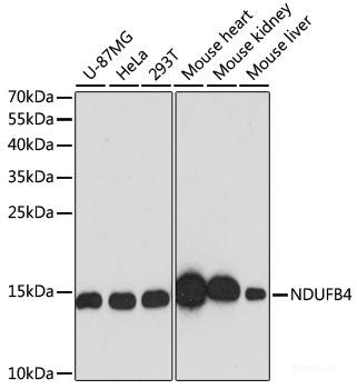 Western blot analysis of extracts of various cell lines using OPRK1 Polyclonal Antibody at dilution of 1:1000.