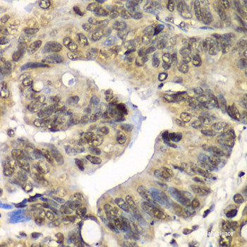 Immunohistochemistry of paraffin-embedded Rat brain using LCAT Polyclonal Antibody at dilution of 1:100 (40x lens).