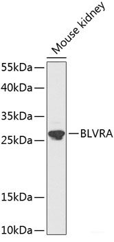 Immunohistochemistry of paraffin-embedded Human liver damage using TUBGCP3 Polyclonal Antibody at dilution of 1:100 (40x lens).