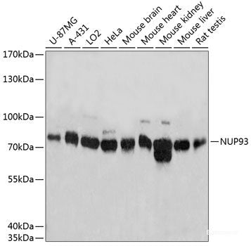 Western blot analysis of extracts of PC-3 cells using WWP1 Polyclonal Antibody.