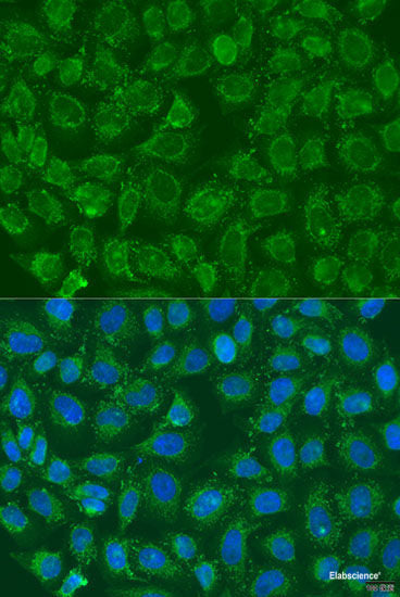 Immunohistochemistry of paraffin-embedded Rat spleen using PRKAB1 Polyclonal Antibody at dilution of 1:100 (40x lens).