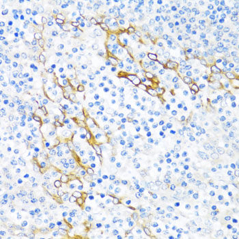 Immunohistochemistry of paraffin-embedded Human kidney using SORT1 Polyclonal Antibody at dilution of 1:100 (40x lens).