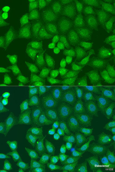 Immunohistochemistry of paraffin-embedded Rat brain using APOL1 Polyclonal Antibody at dilution of 1:100 (40x lens).