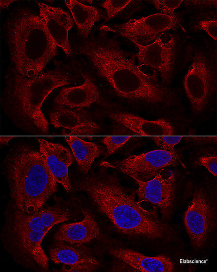 Western blot analysis of extracts of H460 cells using UQCRQ Polyclonal Antibody at dilution of 1:1000.