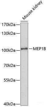 Immunohistochemistry of paraffin-embedded Rat brain using P2RX7 Polyclonal Antibody at dilution of 1:100 (40x lens).