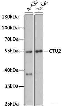 Western blot analysis of extracts of 293T cells using SLC25A38 Polyclonal Antibody at dilution of 1:3000.