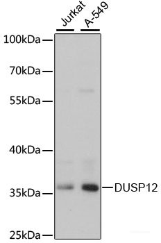 Immunohistochemistry of paraffin-embedded Rat kidney using UPF2 Polyclonal Antibody at dilution of 1:200 (40x lens).