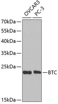 Immunohistochemistry of paraffin-embedded Human lung cancer using MMP25 Polyclonal Antibody at dilution of 1:200 (40x lens).