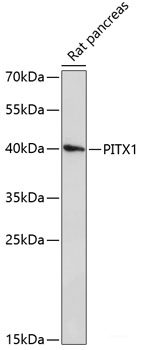 Western blot analysis of extracts of various cell lines using ADI1 Polyclonal Antibody at dilution of 1:3000.