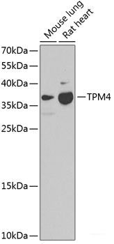 Immunohistochemistry of paraffin-embedded Rat kidney using NAA50 Polyclonal Antibody at dilution of 1:200 (40x lens).