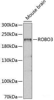 Western blot analysis of extracts of various cell lines using NDC80 Polyclonal Antibody at dilution of 1:1000.