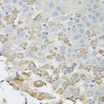 Immunohistochemistry of paraffin-embedded Human prostate using WDR77 Polyclonal Antibody at dilution of 1:200 (40x lens).