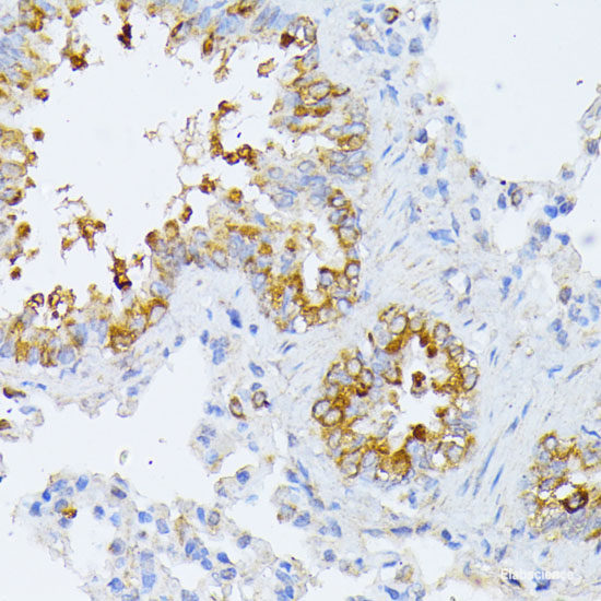 Immunohistochemistry of paraffin-embedded Rat lung using KIAA1456 Polyclonal Antibody at dilution of 1:200 (40x lens).