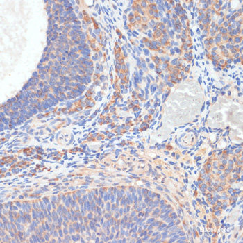 Immunofluorescence analysis of Jurkat cells using CD47 Polyclonal Antibody at dilution of 1:100. Blue: DAPI for nuclear staining.