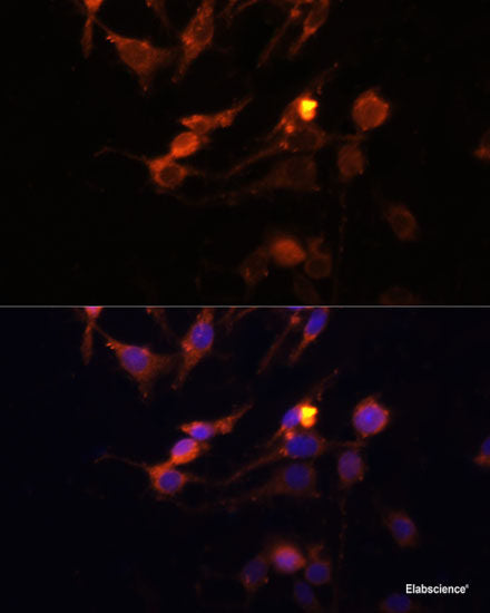 Immunofluorescence analysis of HeLa cells using Twist Polyclonal Antibody at dilution of 1:100. Blue: DAPI for nuclear staining.
