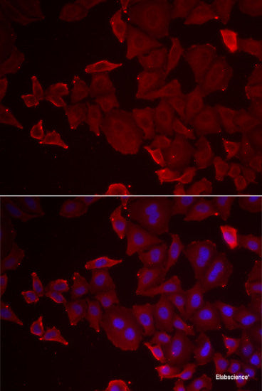 Immunohistochemistry of paraffin-embedded Rat liver using UBE2J2 Polyclonal Antibody at dilution of 1:100 (40x lens).