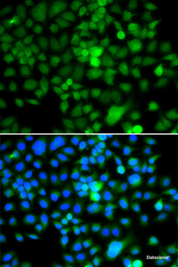 Immunohistochemistry of paraffin-embedded Human colon carcinoma using ZAK Polyclonal Antibody at dilution of 1:100 (40x lens).