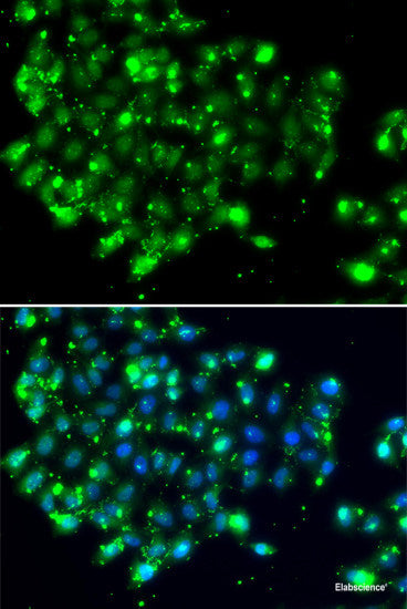 Immunohistochemistry of paraffin-embedded Mouse cancer using UBE2R2 Polyclonal Antibody at dilution of 1:100 (40x lens).