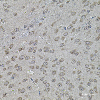 Immunohistochemistry of paraffin-embedded Rat heart using JMJD7 Polyclonal Antibody at dilution of 1:100 (40x lens).
