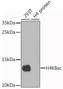 Immunohistochemistry of paraffin-embedded Human gastric using HSPE1 Polyclonal Antibody at dilution of 1:100 (40x lens).