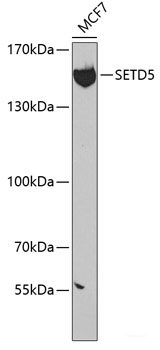 Immunohistochemistry of paraffin-embedded Rat brain using Fibronectin Polyclonal Antibody at dilution of 1:100 (40x lens).