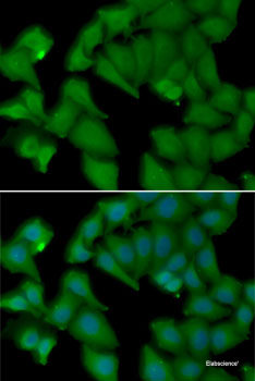 Immunohistochemistry of paraffin-embedded Human kidney using RAB1B Polyclonal Antibody at dilution of 1:100 (40x lens).