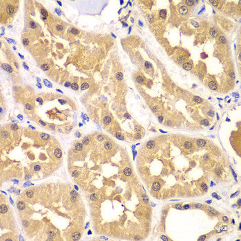 Immunofluorescence analysis of U2OS cells using HSD17B3 Polyclonal Antibody at dilution of 1:100. Blue: DAPI for nuclear staining.