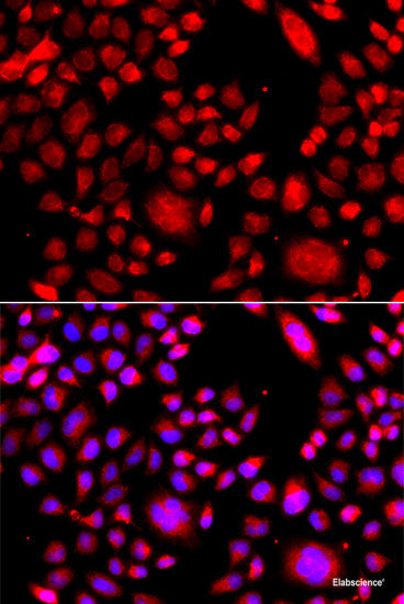 Immunohistochemistry of paraffin-embedded Human gastric using RAC1 Polyclonal Antibody at dilution of 1:100 (40x lens).