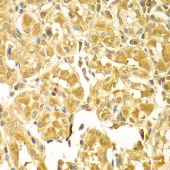 Immunohistochemistry of paraffin-embedded Mouse brain using STRN Polyclonal Antibody at dilution of 1:100 (40x lens).