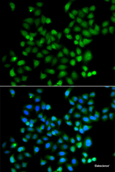 Immunohistochemistry of paraffin-embedded Mouse lung using COQ7 Polyclonal Antibody at dilution of 1:100 (40x lens).