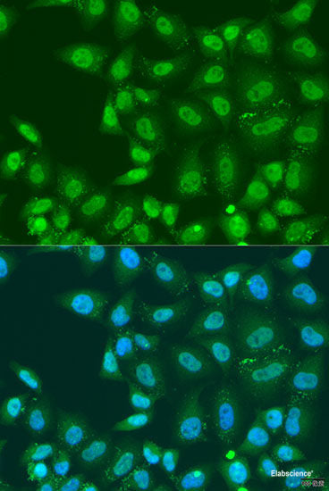 Immunofluorescence analysis of U2OS cells using BLOC1S2 Polyclonal Antibody at dilution of 1:100. Blue: DAPI for nuclear staining.