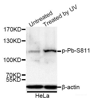 Immunohistochemistry of paraffin-embedded Rat heart using Phospho-GJA1(S368) Polyclonal Antibody at dilution of 1:200 (40x lens).