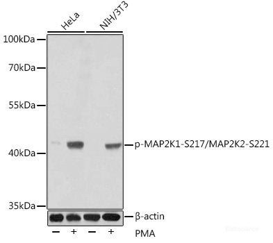 Immunohistochemistry analysis of paraffin-embedded mouse brain using MAP2 Polyclonal Antibody at dilution of 1:300.