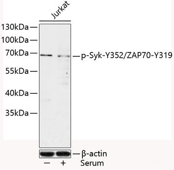 Immunohistochemistry analysis of paraffin-embedded Human tonsil using NLRP3 Polyclonal Antibody at dilution of 1:400.