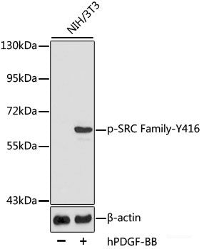 Immunohistochemistry analysis of paraffin-embedded mouse bone using MAGEC1 Polyclonal Antibody at dilution of 1:300.