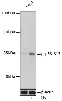 Western Blot analysis of various samples using EZH2 Polyclonal Antibody at dilution of 1:500.