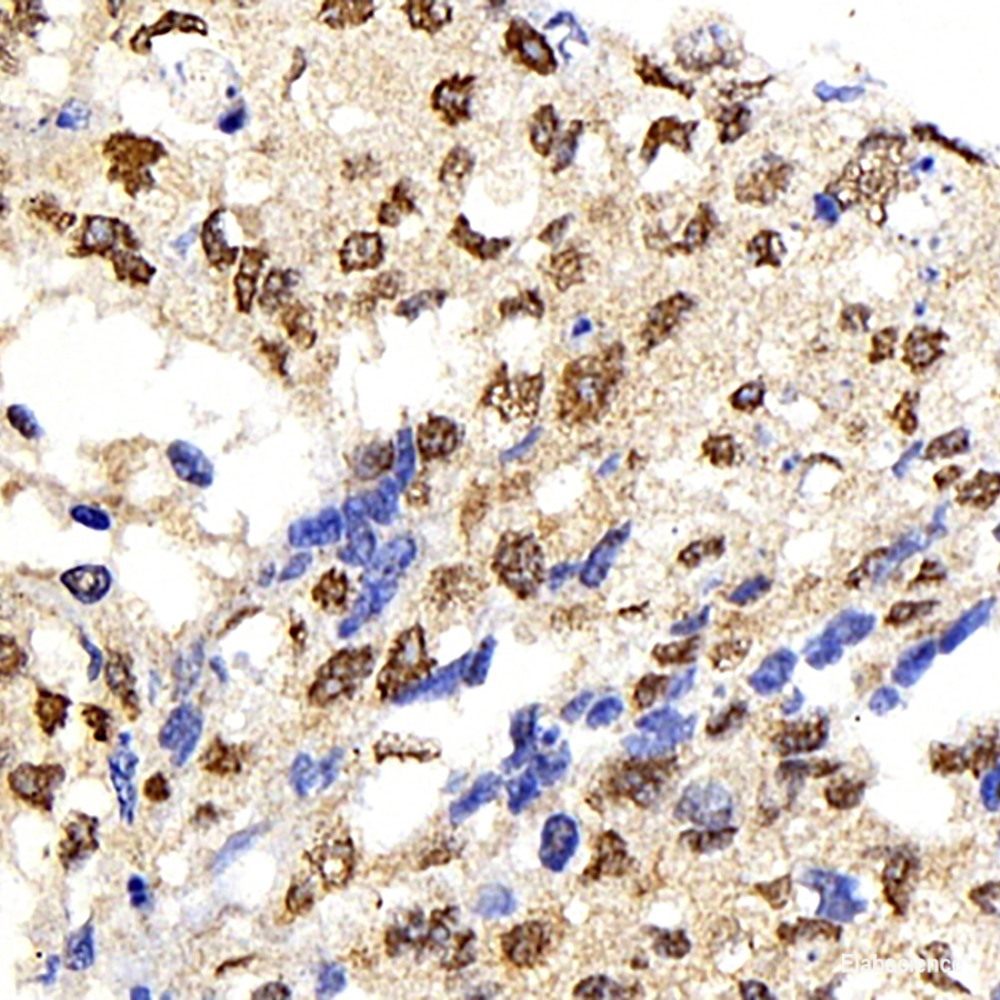 Immunohistochemistry analysis of paraffin-embedded mouse kidney using ROCK1 Polyclonal Antibody at dilution of 1:300.