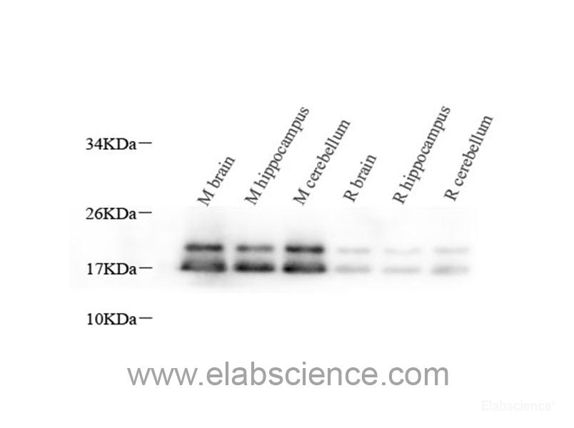 Immunohistochemistry analysis of paraffin-embedded mouse lung using CD68 Polyclonal Antibody at dilution of 1:300.