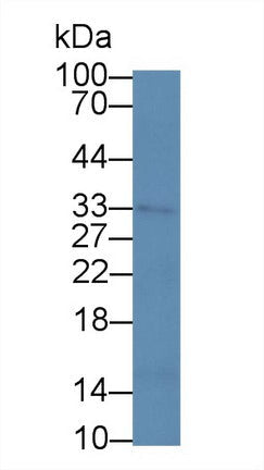 Monoclonal Antibody to Tissue Factor Pathway Inhibitor (TFPI)