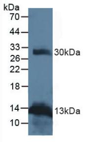 Monoclonal Antibody to Receptor Activator Of Nuclear Factor Kappa B Ligand (RANkL)